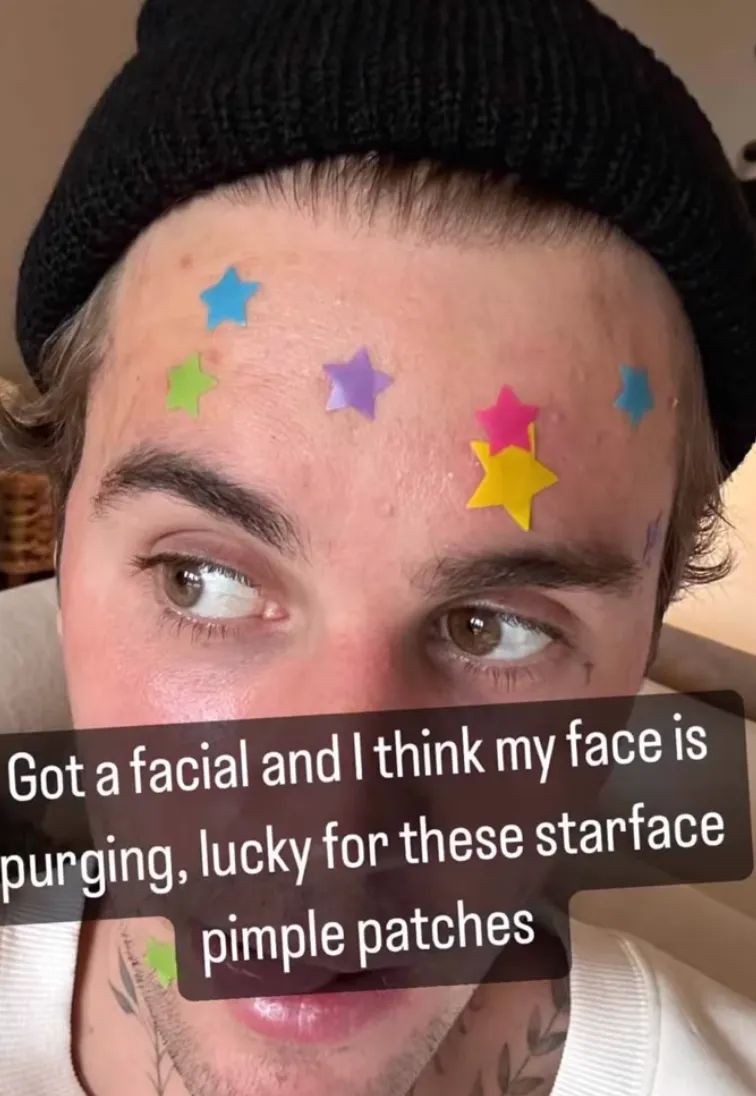 Starface Hydro-Star Pimple Patches   Refillable Compact - 32ct